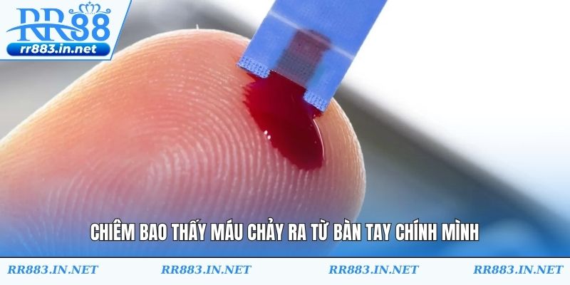 Chiêm bao thấy máu chảy ra từ bàn tay chính mình